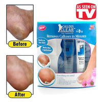 Callous Clear Foot Treatment Kit