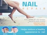 Lanthome Nail Repair