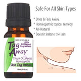 Tag Away Skin Tag Removal, 10mL (0.34 fl. oz. )