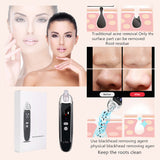 VLEE Blackhead Acne Remover